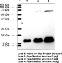 Prostaglandin E Synthase-<wbr/>1 (microsomal) Polyclonal Antibody