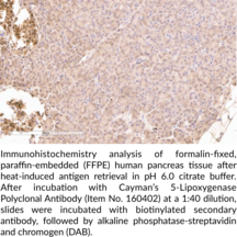 5-Lipoxygenase Polyclonal Antibody