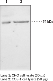 iPLA<sub>2</sub> (Type VI) Polyclonal Antibody