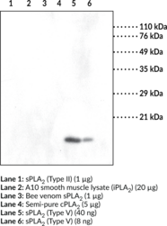 sPLA<sub>2</sub> (human Type V) Monoclonal Antibody (Clone MCL-<wbr/>3G1)