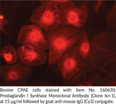 Prostaglandin I Synthase Monoclonal Antibody (Clone isn-<wbr/>1)