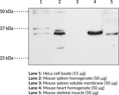 TRAIL Polyclonal Antibody