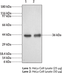 DcR2 Polyclonal Antibody