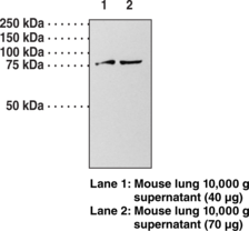 Guanylate Cyclase ? subunit (soluble) Polyclonal Antibody