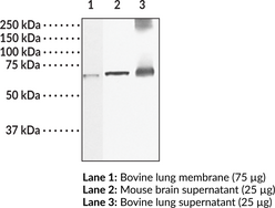 Guanylate Cyclase ?1 subunit (soluble) Polyclonal Antibody