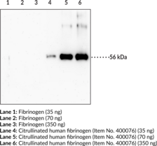 Citrullinated Fibrinogen Monoclonal Antibody (Clone 10E9.3)