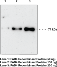 PAD4 Monoclonal Antibody (Clone 11F9)