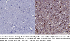 PAD2 Monoclonal Antibody (Clone 9F7)