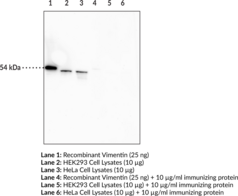 Vimentin Monoclonal Antibody (Clone 12E4)