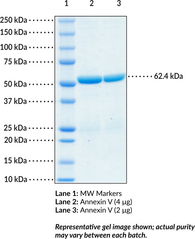 Annexin V (human, recombinant)