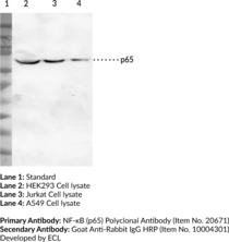 NF-?B (p65) Polyclonal Antibody