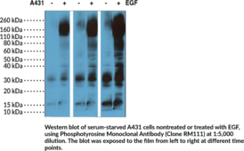 Phosphotyrosine Monoclonal Antibody