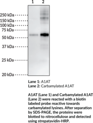 Carbamylated Alpha-1 Antitrypsin