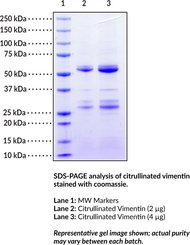 Citrullinated Vimentin (human, recombinant)