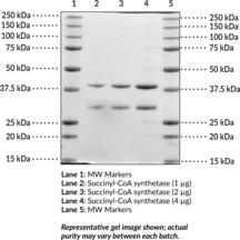 Succinyl-CoA synthetase