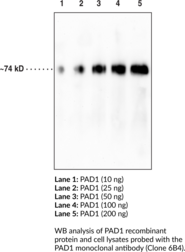 PAD1 Monoclonal Antibody (Clone 6B4)