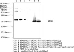 Hsp27 (HspB1) Polyclonal Antibody