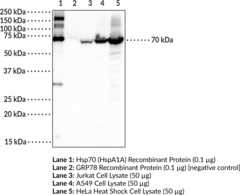 Hsp70 (HspA1A) Polyclonal Antibody