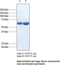 Alpha-1 Antitrypsin