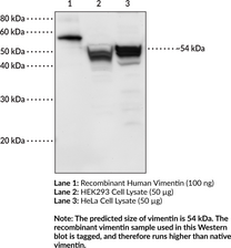 Vimentin Polyclonal Antibody