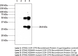 STING M284 variant Monoclonal Antibody (Clone 8E7)