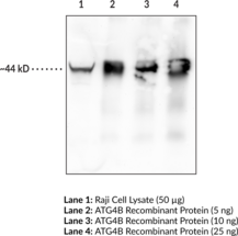 ATG4B Monoclonal Antibody (Clone 8A5)