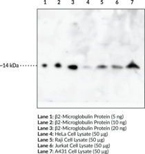 β2-Microglobulin Polyclonal Antibody