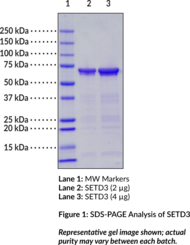 SETD3 (human, recombinant)