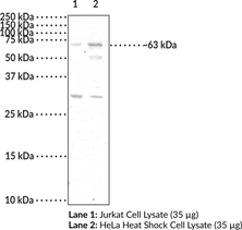 YTHDF2 Polyclonal Antibody