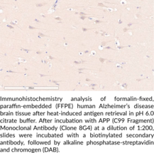 APP (C99 Fragment) Monoclonal Antibody (Clone 8G4)