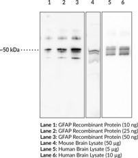 GFAP Polyclonal Antibody