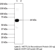 METTL16 Monoclonal Antibody