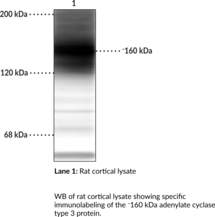 Adenylate Cyclase Type 3 Polyclonal Antibody