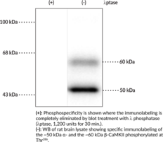 CaMKII (Phospho-Thr<sup>286</sup>) Polyclonal Antibody