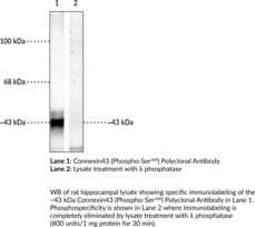 Connexin43 (Phospho-<wbr/>Ser<sup>368</sup>) Polyclonal Antibody