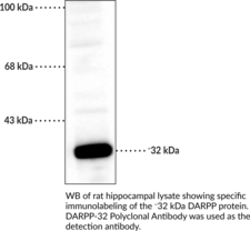 DARPP-32 Polyclonal Antibody