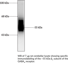 GABA<sub>A</sub> Receptor ?<sub>2</sub> Subunit Polyclonal Antibody