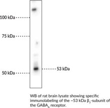 GABA<sub>A</sub> Receptor ?<sub>3</sub> Subunit Polyclonal Antibody