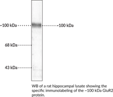 GluR2 Polyclonal Antibody