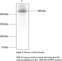 MAP2 (bovine) Monoclonal Antibody (Clone 4H5)