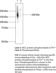 NCC (Phospho-<wbr/>Thr<sup>53</sup>) Polyclonal Antibody