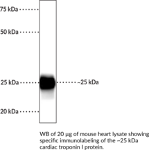Cardiac Troponin I Polyclonal Antibody