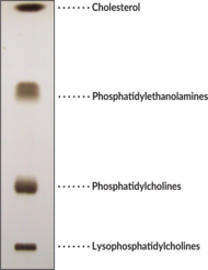 Polar Lipid Mixture (egg, ovine)