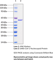 SARS-CoV-2 Nucleocapsid Protein