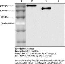 ACE2 (human) Monoclonal Antibody (Clone AC18F)