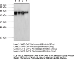 SARS-CoV/SARS-CoV-2 Nucleocapsid Protein Rabbit Monoclonal Antibody (Clone 001)