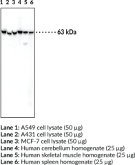 Glucose-6-phosphate Isomerase Monoclonal Antibody (Clone 5B6)