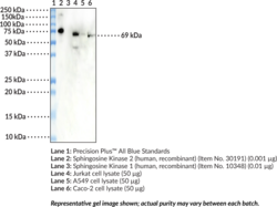 Sphingosine Kinase 2 Monoclonal Antibody (Clone 2C6)