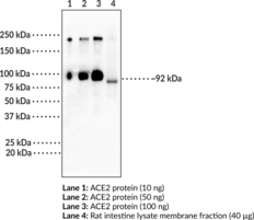 ACE2 (human) Monoclonal Antibody (Clone 8G5)