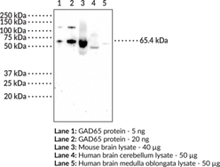 GAD65 Monoclonal Antibody